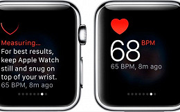 Apple Watch consegue detectar diabetes em 85% dos testes